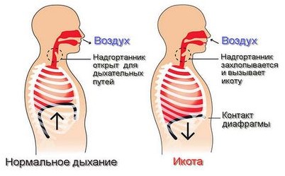 избавиться избавиться
