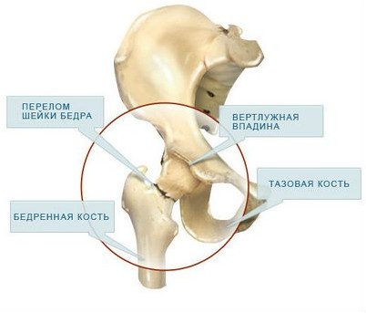 вмешательство вмешательство