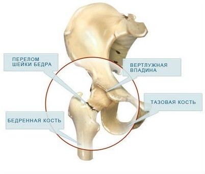 вмешательство