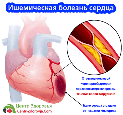 уровень уровень